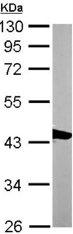 Western blot - Anti-Actin Regulatory Protein CAPG/MCP antibody (AB155688)