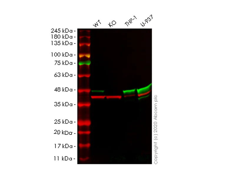 Western blot - Anti-Actin Regulatory Protein CAPG/MCP antibody [EPR13194-34] (AB181095)