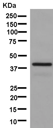 Western blot - Anti-Actin Regulatory Protein CAPG/MCP antibody [EPR13194-34] (AB181095)