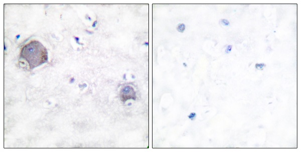 Immunohistochemistry (Formalin/PFA-fixed paraffin-embedded sections) - Anti-activated Notch1 antibody (AB52301), expandable thumbnail