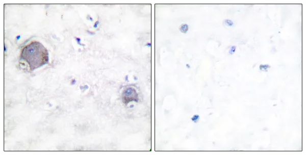 Immunohistochemistry (Formalin/PFA-fixed paraffin-embedded sections) - Anti-activated Notch1 antibody (AB52301)