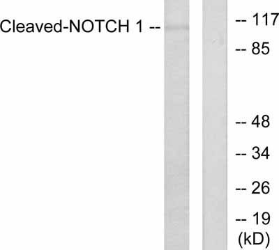 Western blot - Anti-activated Notch1 antibody (AB52301), expandable thumbnail