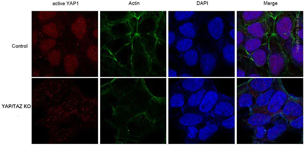Immunocytochemistry/ Immunofluorescence - Anti-active YAP1 antibody [EPR19812] (AB205270)