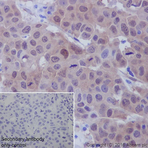 Immunohistochemistry (Formalin/PFA-fixed paraffin-embedded sections) - Anti-active YAP1 antibody [EPR19812] (AB205270)