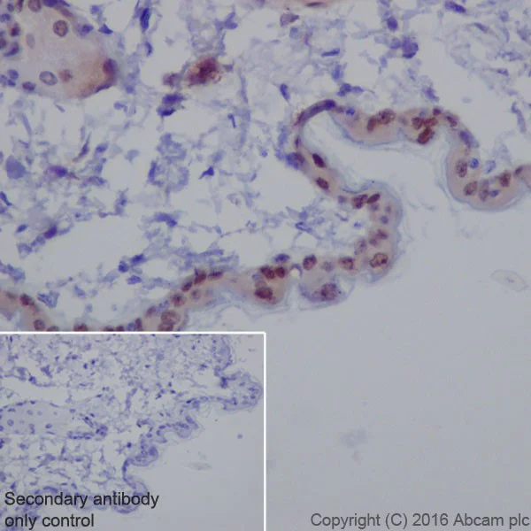 Immunohistochemistry (Formalin/PFA-fixed paraffin-embedded sections) - Anti-active YAP1 antibody [EPR19812] (AB205270)