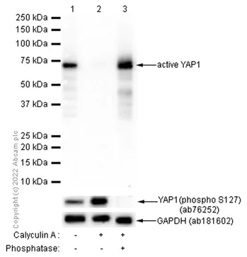 Western blot - Anti-active YAP1 antibody [EPR19812] (AB205270)