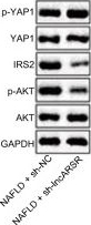 Western blot - Anti-active YAP1 antibody [EPR19812] (ab205270), expandable thumbnail