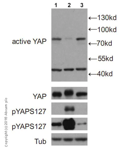 Western blot - Anti-active YAP1 antibody [EPR19812] (AB205270)