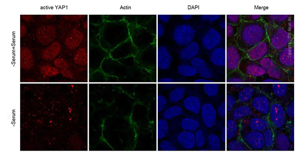 Immunocytochemistry/ Immunofluorescence - Anti-active YAP1 antibody [EPR19812] - BSA and Azide free (AB223126)