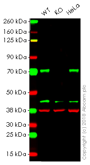 Anti-active YAP1 antibody [EPR19812] - BSA and Azide free