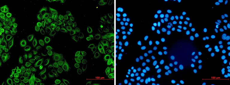 Immunocytochemistry/ Immunofluorescence - Anti-Activin A Receptor Type IB/ALK-4 Antibody [S08-8D6] (AB317379)
