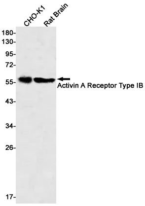 Western blot - Anti-Activin A Receptor Type IB/ALK-4 Antibody [S08-8D6] (AB317379)