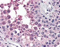 Immunohistochemistry (Formalin/PFA-fixed paraffin-embedded sections) - Anti-Activin Receptor Type IA antibody (AB115301)