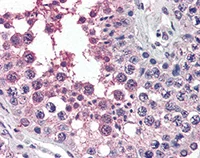 Immunohistochemistry (Formalin/PFA-fixed paraffin-embedded sections) - Anti-Activin Receptor Type IA antibody (AB115301)