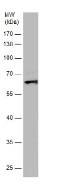 Western blot - Anti-Activin Receptor Type IA antibody (AB262699)