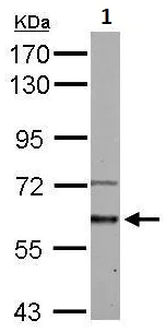 Western blot - Anti-Activin Receptor Type IA antibody (AB262699)