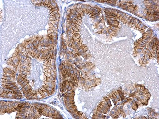 Immunohistochemistry (Formalin/PFA-fixed paraffin-embedded sections) - Anti-Activin Receptor Type IA antibody (AB262702)