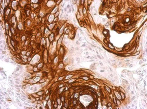 Immunohistochemistry (Formalin/PFA-fixed paraffin-embedded sections) - Anti-Activin Receptor Type IA antibody (AB262702)