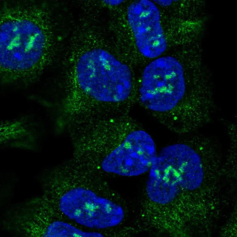 Immunocytochemistry/ Immunofluorescence - Anti-Activin Receptor Type IA antibody (AB262856)