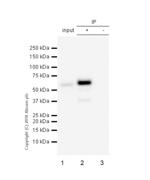 Immunoprecipitation - Anti-Activin Receptor Type IA antibody [EPR4076(2)] (AB155981)