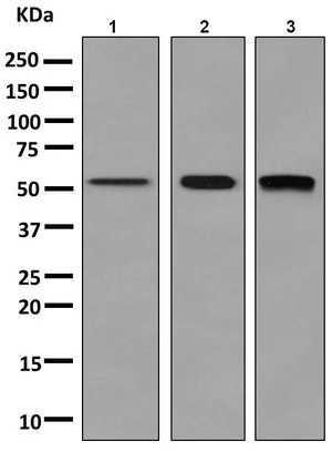 Western blot - Anti-Activin Receptor Type IA antibody [EPR4076(2)] (AB155981)