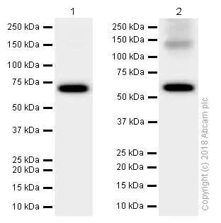 Western blot - Anti-Activin Receptor Type IA antibody [EPR4076(2)] (AB155981)