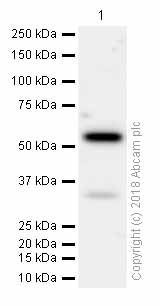 Western blot - Anti-Activin Receptor Type IA antibody [EPR4076(2)] (AB155981)
