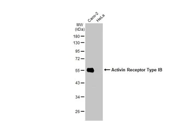 Western blot - Anti-Activin Receptor Type IB/BALK-4 antibody [HL1266] - BSA and Azide free (AB313839)