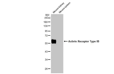 Western blot - Anti-Activin Receptor Type IB/BALK-4 antibody [HL1266] - BSA and Azide free (AB313839)