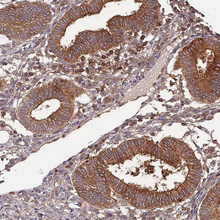 Immunohistochemistry (Formalin/PFA-fixed paraffin-embedded sections) - Anti-Activin Receptor Type IIA/ACVR2A antibody (AB262900)