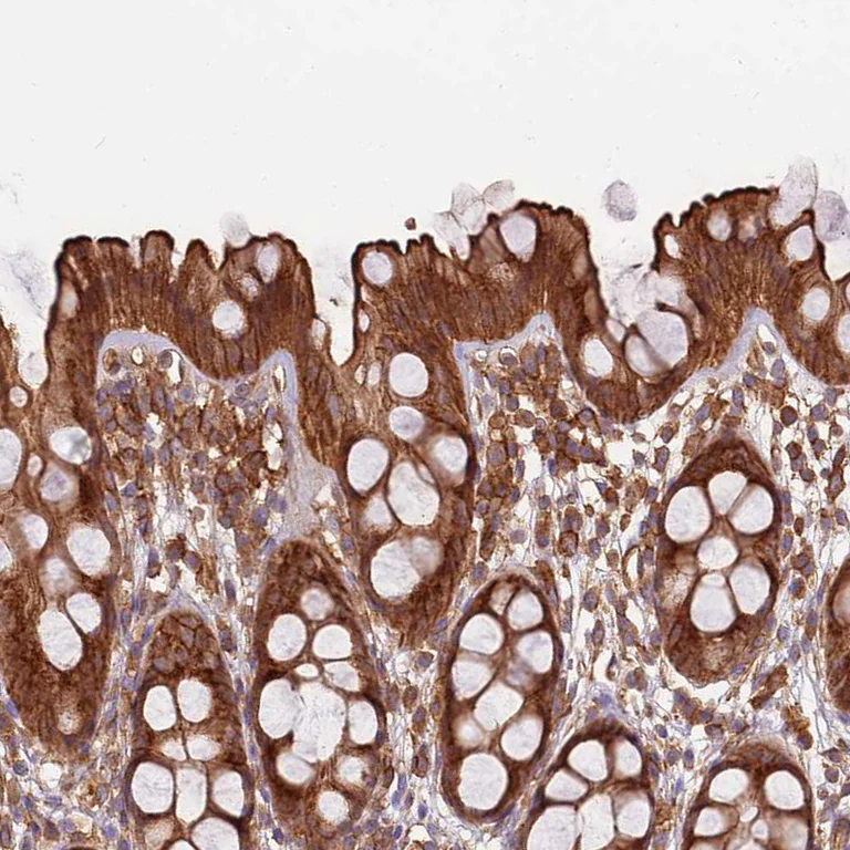 Immunohistochemistry (Formalin/PFA-fixed paraffin-embedded sections) - Anti-Activin Receptor Type IIA/ACVR2A antibody (AB262900)