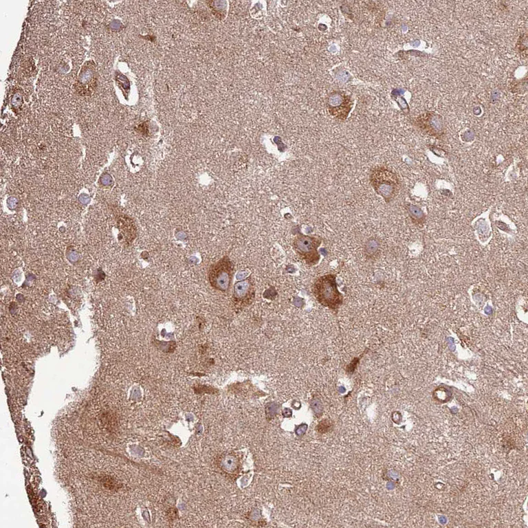 Immunohistochemistry (Formalin/PFA-fixed paraffin-embedded sections) - Anti-Activin Receptor Type IIA/ACVR2A antibody (AB262900)