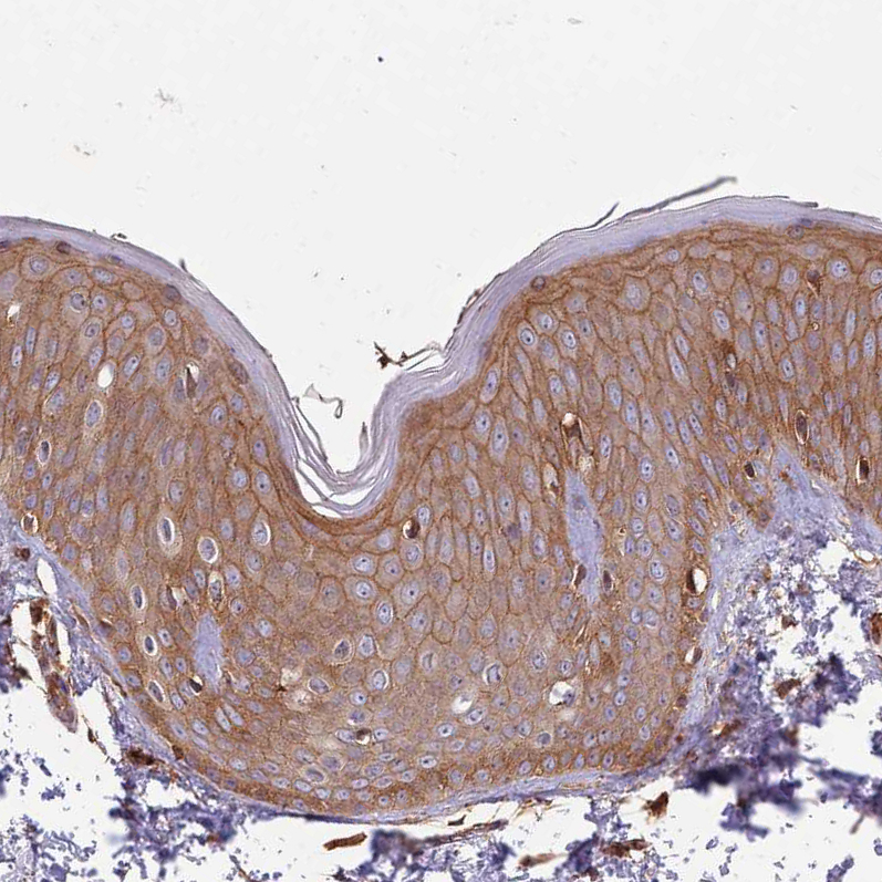 Immunohistochemistry (Formalin/PFA-fixed paraffin-embedded sections) - Anti-Activin Receptor Type IIA/ACVR2A antibody (AB262900)