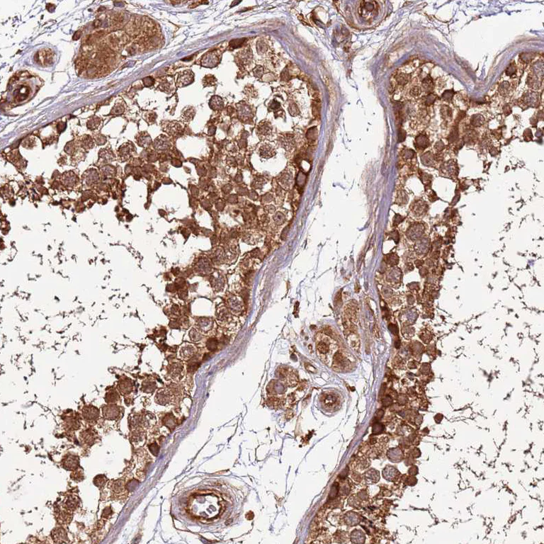 Immunohistochemistry (Formalin/PFA-fixed paraffin-embedded sections) - Anti-Activin Receptor Type IIA/ACVR2A antibody (AB262900)
