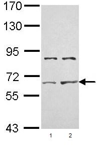 Western blot - Anti-Activin Receptor Type IIA/ACVR2A antibody (AB96793), expandable thumbnail