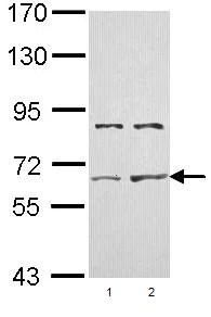 Western blot - Anti-Activin Receptor Type IIA/ACVR2A antibody (AB96793)