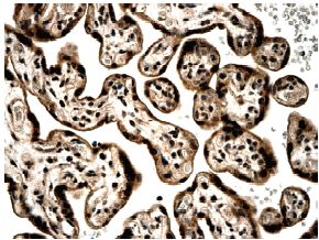 Immunohistochemistry (Formalin/PFA-fixed paraffin-embedded sections) - Anti-Activin Receptor Type IIA/ACVR2A antibody [MM0058-6J16] (AB78412)
