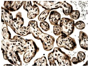 Immunohistochemistry (Formalin/PFA-fixed paraffin-embedded sections) - Anti-Activin Receptor Type IIA/ACVR2A antibody [MM0058-6J16] (AB78412)