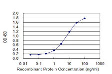 ELISA - Anti-Activin Receptor Type IIB/ACVR2B antibody [1C11] (AB76940)