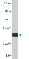 Western blot - Anti-Activin Receptor Type IIB/ACVR2B antibody [1C11] (AB76940)
