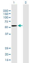 Western blot - Anti-Activin Receptor Type IIB/ACVR2B antibody [1C11] (AB76940)