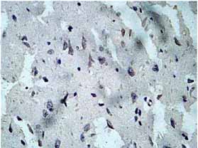 Immunohistochemistry (Formalin/PFA-fixed paraffin-embedded sections) - Anti-Activin Receptor Type IIB/ACVR2B antibody (AB128544)