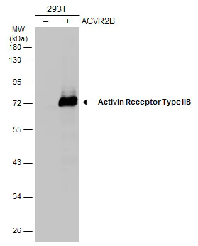 Anti-Activin Receptor Type IIB/ACVR2B antibody (ab272869) | Abcam