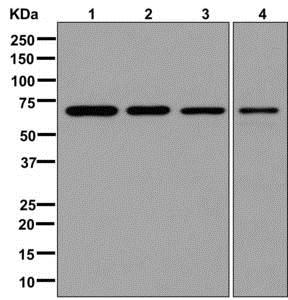 Western blot - Anti-Activin Receptor Type IIB/ACVR2B antibody [EPR10739] (AB180185)