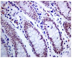 Immunohistochemistry (Formalin/PFA-fixed paraffin-embedded sections) - Anti-ACTL6A antibody [EPR7443] (AB131272)