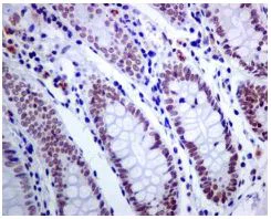 Immunohistochemistry (Formalin/PFA-fixed paraffin-embedded sections) - Anti-ACTL6A antibody [EPR7443] - BSA and Azide free (AB226119)
