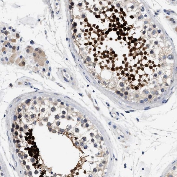 Immunohistochemistry (Formalin/PFA-fixed paraffin-embedded sections) - Anti-ACTL7B antibody (AB223716)