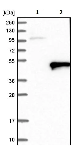 Western blot - Anti-ACTL7B antibody (AB223716)