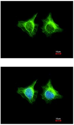 Immunocytochemistry/ Immunofluorescence - Anti-ACTL8 antibody (AB96756), expandable thumbnail
