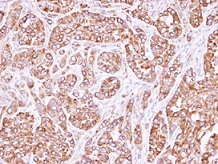 Immunohistochemistry (Formalin/PFA-fixed paraffin-embedded sections) - Anti-ACTL8 antibody (AB96756), expandable thumbnail